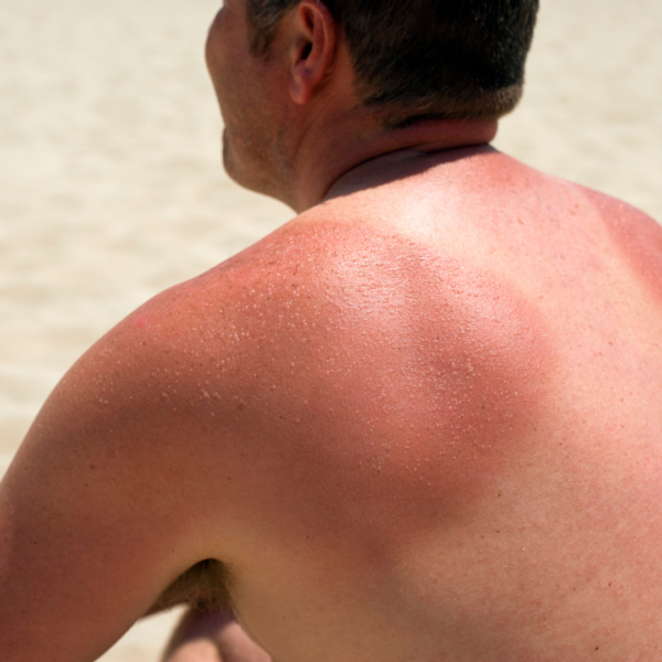 Skin Repair Oil - Image 4