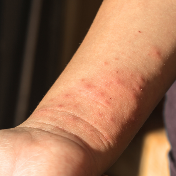 Skin Repair Oil - Image 6